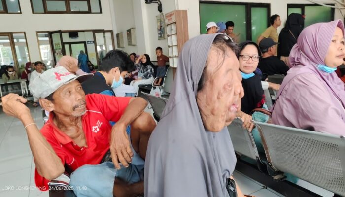 Pilu Wajah Kholipah Tumbuh Akar, Derita Sejak Lahir